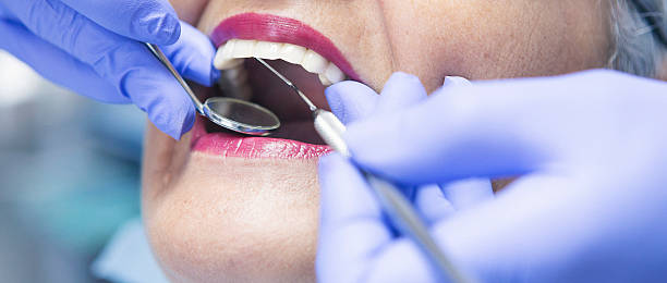 Best Emergency Tooth Extraction in Harrisburg, OR